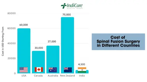 Cost of Spinal Fusion Surgery in Different Countries